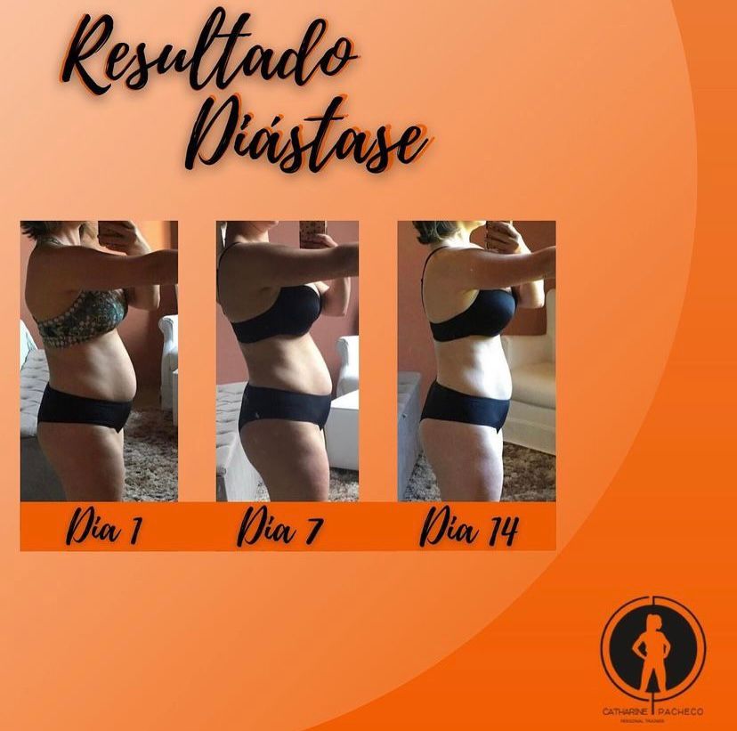 Transformação 1 - Antes e Depois