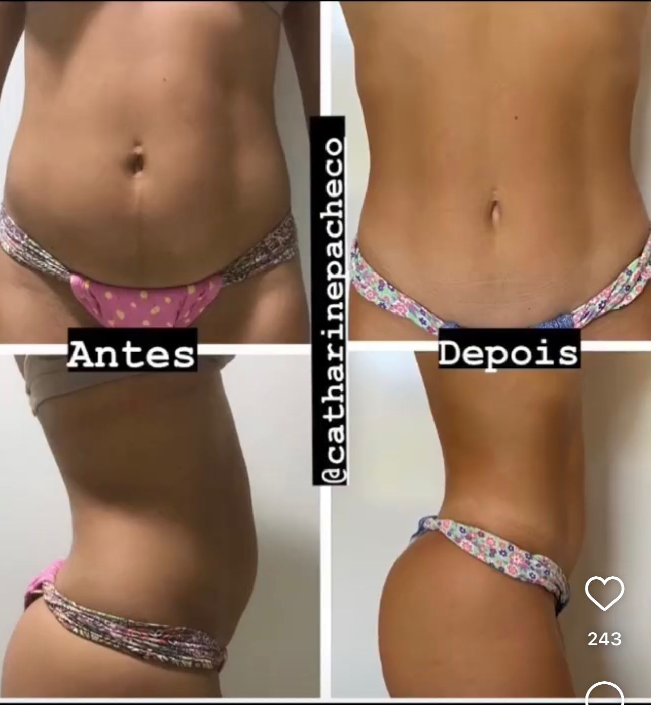 Transformação 4 - Antes e Depois